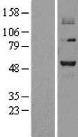 PRMT2 Human Over-expression Lysates NM_001535