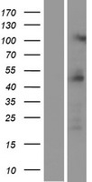 PRMT2 Human Over-expression Lysates NM_206962