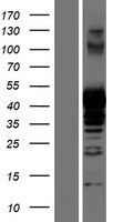 PRMT1 Human Over-expression Lysates NM_001536
