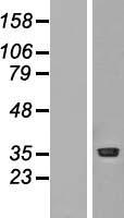 PRMT1 Human Over-expression Lysates NM_198319