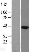 ls003291 hsd11b2 human over expression lysates nm 000196 wb testing 1
