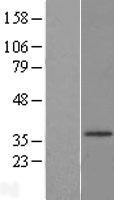 ls003293 hsd17b3 human over expression lysates nm 000197 wb testing 1