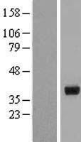 HSD17B2 Human Over-expression Lysates NM_002153