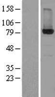 ls003295 hydroxysteroid 17 beta dehydrogenase 4 hsd17b4 human over expression lysates nm 000414 wb testing 1