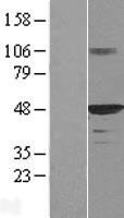 HDJ2 (DNAJA1) Human Over-expression Lysates NM_001539