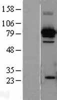 Hsc70 (HSPA8) Human Over-expression Lysates NM_006597