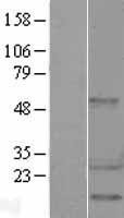 HSP27 (HSPB1) Human Over-expression Lysates NM_001540