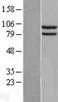 HSP90AA1 Human Over-expression Lysates NM_001017963