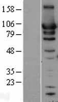 HSP90AB1 Human Over-expression Lysates NM_007355
