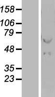 Hsp60 (HSPD1) Human Over-expression Lysates NM_199440