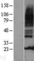 ls003359 5ht3a receptor htr3a human over expression lysates nm 213621 wb testing 1