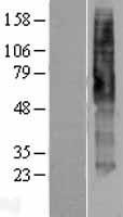 5HT4 Receptor (HTR4) Human Over-expression Lysates NM_001040171
