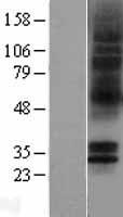 5HT5A receptor (HTR5A) Human Over-expression Lysates NM_024012