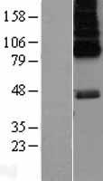 5HT6 Receptor (HTR6) Human Over-expression Lysates NM_000871