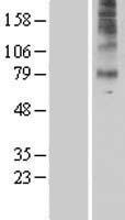 5HT7 Receptor (HTR7) Human Over-expression Lysates NM_019860