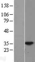 HUS1 Human Over-expression Lysates NM_004507