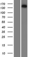 Isoleucyl tRNA synthetase (IARS) Human Over-expression Lysates NM_002161