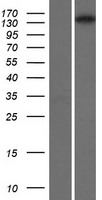 Isoleucyl tRNA synthetase (IARS) Human Over-expression Lysates NM_013417