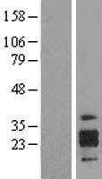 ICAM4 Human Over-expression Lysates NM_001039132