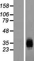 ICAM4 Human Over-expression Lysates NM_001544