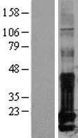ID1 Human Over-expression Lysates NM_002165