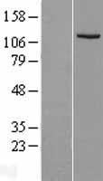 IDE Human Over-expression Lysates NM_004969