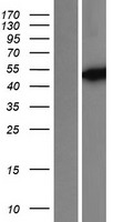 Isocitrate dehydrogenase (IDH1) Human Over-expression Lysates NM_005896