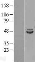 IDH2 Human Over-expression Lysates NM_002168