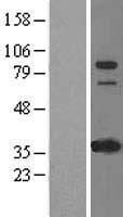 IFI16 Human Over-expression Lysates NM_005531