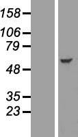 IFIT2 Human Over-expression Lysates NM_001547