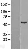 IFIT1 Human Over-expression Lysates NM_001548