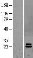 Interferon alpha 2 (IFNA2) Human Over-expression Lysates NM_000605