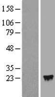IFNA4 Human Over-expression Lysates NM_021068