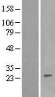Interferon alpha 8 (IFNA8) Human Over-expression Lysates NM_002170