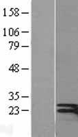 Interferon gamma (IFNG) Human Over-expression Lysates NM_000619