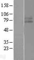 IFNGR1 Human Over-expression Lysates NM_000416