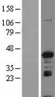 IGBP1 Human Over-expression Lysates NM_001551