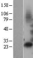 IGFBP1 Human Over-expression Lysates NM_000596