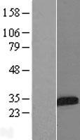 ls003488 igfbp5 human over expression lysates nm 000599 wb testing 1