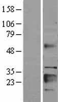 IGFBP6 Human Over-expression Lysates NM_002178