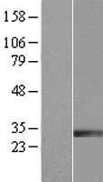 IGFBP7 Human Over-expression Lysates NM_001553