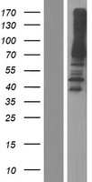 RED (IK) Human Over-expression Lysates NM_006083
