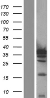IL1 beta (IL1B) Human Over-expression Lysates NM_000576