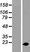 IL1RA (IL1RN) Human Over-expression Lysates NM_000577