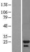 IL1RA (IL1RN) Human Over-expression Lysates NM_173841