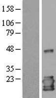 IL1RA (IL1RN) Human Over-expression Lysates NM_173842