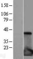 ls003557 il1ra il1rn human over expression lysates nm 173843 wb testing 4