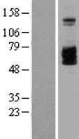 IL2 Receptor beta (IL2RB) Human Over-expression Lysates NM_000878