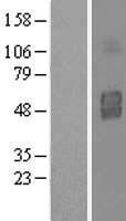 IL3RA Human Over-expression Lysates NM_002183