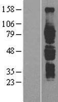 IL6R Human Over-expression Lysates NM_000565